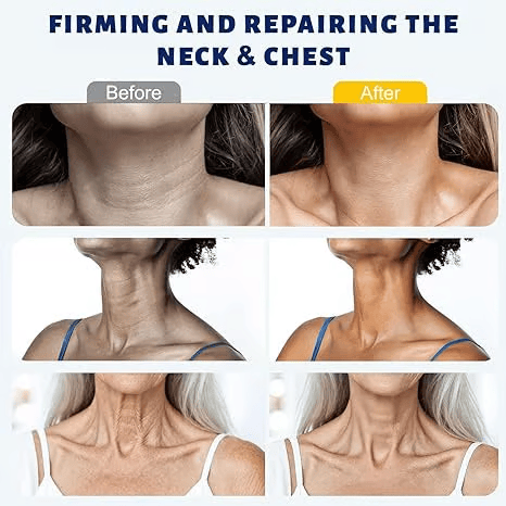 ✨ Awzlove®Instant Neck Lift Cream  — Infused with Retinol & Hyaluronic Acid | Firms the Neck, Reduces Wrinkles & Double Chin🧴🧴1